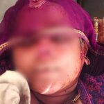 दामाद ने कैंची से काटी सास की नाक, सोने के आभूषण लेकर फरार